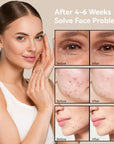 7 Colors LED Light Therapy Facial Mask