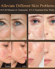 7 Colors LED Light Therapy Facial Mask